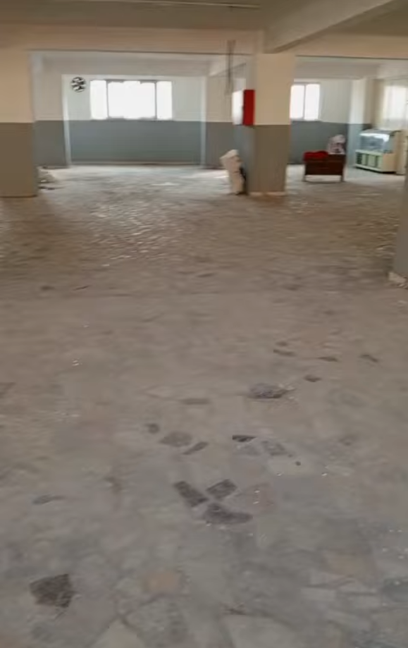 Paladyen Silim Sonrası Görünüm